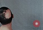 Standbild Haarausfall Nagasaki Japan, 1946, aus Sekunde 44 historischem Filmmaterial Videoclip 65675042176