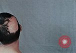 Standbild Haarausfall Nagasaki Japan, 1946, aus Sekunde 46 historischem Filmmaterial Videoclip 65675042176