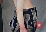 Image of flash burn on face from atomic bomb Nagasaki Japan, 1946, second 23 stock footage video 65675042177