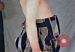 Image of flash burn on face from atomic bomb Nagasaki Japan, 1946, second 24 stock footage video 65675042177