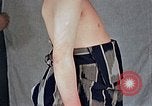 Image of flash burn on face from atomic bomb Nagasaki Japan, 1946, second 25 stock footage video 65675042177