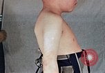 Image of flash burn on face from atomic bomb Nagasaki Japan, 1946, second 29 stock footage video 65675042177
