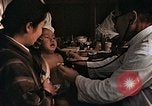 Image eye plaie de bombe atomique Hiroshima au Japon, 1946, de la seconde 61 séquences d'archives historiques vidéo 65675042180
