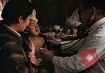 Image eye plaie de bombe atomique Hiroshima au Japon, 1946, de la seconde 62 séquences d'archives historiques vidéo 65675042180