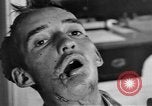 Image of Allied soldiers France, 1918, second 50 stock footage video 65675042379