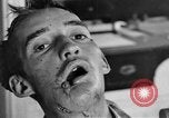 Image of Allied soldiers France, 1918, second 51 stock footage video 65675042379