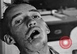 Image of Allied soldiers France, 1918, second 54 stock footage video 65675042379