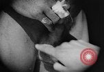 Image of skin burned by gas attack on WWI soldiers France, 1918, second 24 stock footage video 65675042403