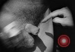 Image of skin burned by gas attack on WWI soldiers France, 1918, second 26 stock footage video 65675042403