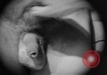 Image of skin burned by gas attack on WWI soldiers France, 1918, second 28 stock footage video 65675042403