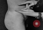 Image of skin burned by gas attack on WWI soldiers France, 1918, second 40 stock footage video 65675042403