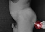 Image of skin burned by gas attack on WWI soldiers France, 1918, second 57 stock footage video 65675042403