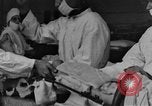 Image of operating a leg France, 1918, second 1 stock footage video 65675042404
