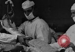 Image of operating a leg France, 1918, second 3 stock footage video 65675042404