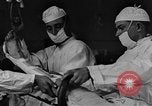 Image of operating a leg France, 1918, second 4 stock footage video 65675042404