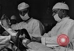 Image of operating a leg France, 1918, second 5 stock footage video 65675042404