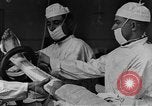 Image of operating a leg France, 1918, second 6 stock footage video 65675042404