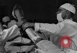 Image of operating a leg France, 1918, second 11 stock footage video 65675042404