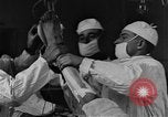 Image of operating a leg France, 1918, second 13 stock footage video 65675042404