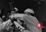 Image of operating a leg France, 1918, second 18 stock footage video 65675042404