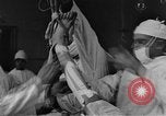 Image of operating a leg France, 1918, second 23 stock footage video 65675042404