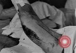Image of operating a leg France, 1918, second 27 stock footage video 65675042404