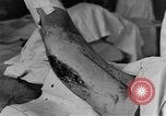 Image of operating a leg France, 1918, second 28 stock footage video 65675042404