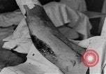 Image of operating a leg France, 1918, second 33 stock footage video 65675042404