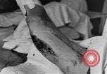 Image of operating a leg France, 1918, second 34 stock footage video 65675042404