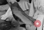 Image of operating a leg France, 1918, second 36 stock footage video 65675042404