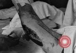 Image of operating a leg France, 1918, second 37 stock footage video 65675042404