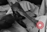 Image of operating a leg France, 1918, second 39 stock footage video 65675042404