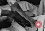 Image of operating a leg France, 1918, second 40 stock footage video 65675042404