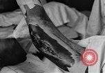 Image of operating a leg France, 1918, second 41 stock footage video 65675042404