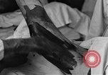 Image of operating a leg France, 1918, second 42 stock footage video 65675042404