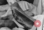 Image of operating a leg France, 1918, second 43 stock footage video 65675042404
