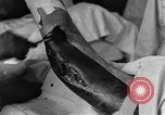 Image of operating a leg France, 1918, second 44 stock footage video 65675042404