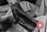 Image of operating a leg France, 1918, second 45 stock footage video 65675042404