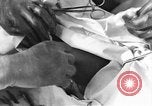 Image of operating a leg France, 1918, second 47 stock footage video 65675042404