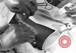 Image of operating a leg France, 1918, second 48 stock footage video 65675042404