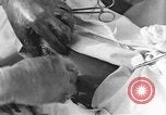 Image of operating a leg France, 1918, second 49 stock footage video 65675042404