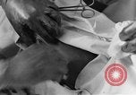 Image of operating a leg France, 1918, second 50 stock footage video 65675042404