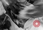 Image of operating a leg France, 1918, second 51 stock footage video 65675042404