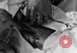 Image of operating a leg France, 1918, second 52 stock footage video 65675042404