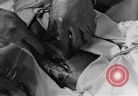 Image of operating a leg France, 1918, second 53 stock footage video 65675042404