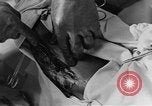 Image of operating a leg France, 1918, second 54 stock footage video 65675042404