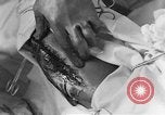 Image of operating a leg France, 1918, second 56 stock footage video 65675042404