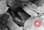 Image of operating a leg France, 1918, second 58 stock footage video 65675042404