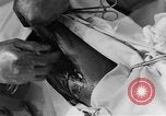 Image of operating a leg France, 1918, second 59 stock footage video 65675042404