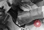 Image of operating a leg France, 1918, second 60 stock footage video 65675042404